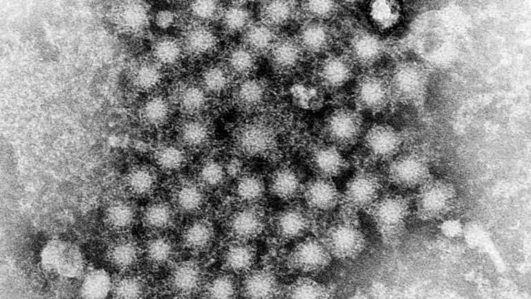 COVID-19: Is DOH in Martin County ready for coronavirus after Hep A debacle in 2019?