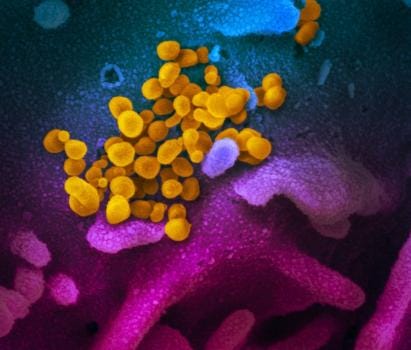 This scanning electron microscope image shows SARS-CoV-2 (yellow)—also known as 2019-nCoV, the virus that causes COVID-19—isolated from a patient in the U.S., emerging from the surface of cells (blue/pink) cultured in the lab.