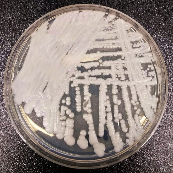 This 2016 photo made available by the Centers for Disease Control and Prevention shows a strain of Candida auris cultured in a petri dish at a CDC laboratory.